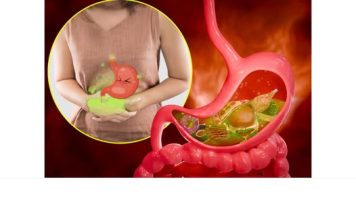 10 namirnica koje izazivaju gasove i nadutost: Pasulj jeste glavni, ali ne i jedini krivac