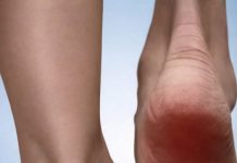 BOLE VAS PETE POSLIJE DUGOG STAJANJA? Rješenje za ovaj problem imate u okviru svog doma