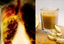 ZA ONE KOJU PUŠE DUŽE OD 5 GODINA: Recept kojim ćete potpuno očistiti vaša pluća