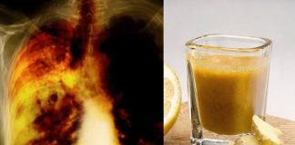 ZA ONE KOJU PUŠE DUŽE OD 5 GODINA: Recept kojim ćete potpuno očistiti vaša pluća