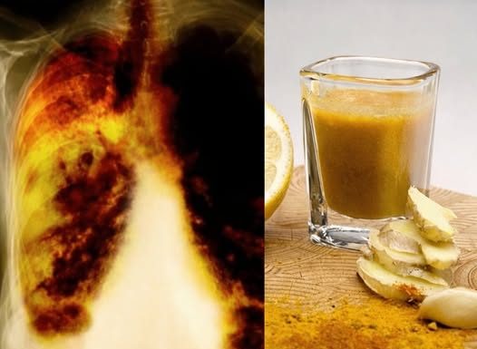 ZA ONE KOJU PUŠE DUŽE OD 5 GODINA: Recept kojim ćete potpuno očistiti vaša pluća