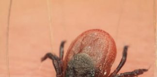 Počela je sezona krpelja, evo kako se zaštiti i kako ga odstraniti iz kože