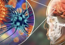 Koji su simptomi, kako se širi i kako se liječi meningitis B?