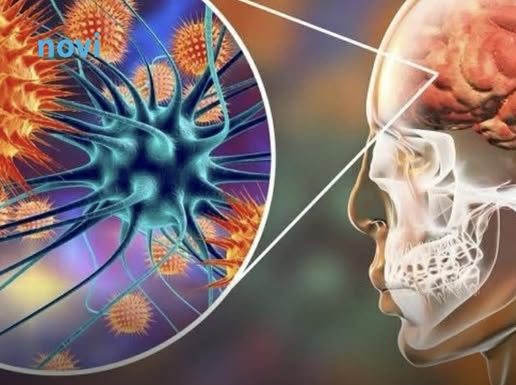 Koji su simptomi, kako se širi i kako se liječi meningitis B?