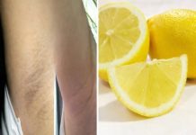 Tamne mrlje ispod pazuha – 5 prirodnih rješenja