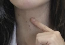 ŠTITNA ŽLIJEZDA SE PREPORODI ZA NEKOLIKO NEDJELJA: Dovedite hormone u red prirodnim sredstvima