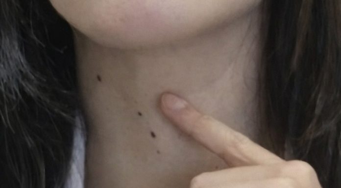 ŠTITNA ŽLIJEZDA SE PREPORODI ZA NEKOLIKO NEDJELJA: Dovedite hormone u red prirodnim sredstvima