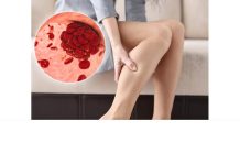 Kako da prepoznate tromb u telu? Ne ignorišite ovih 8 znakova upozorenja