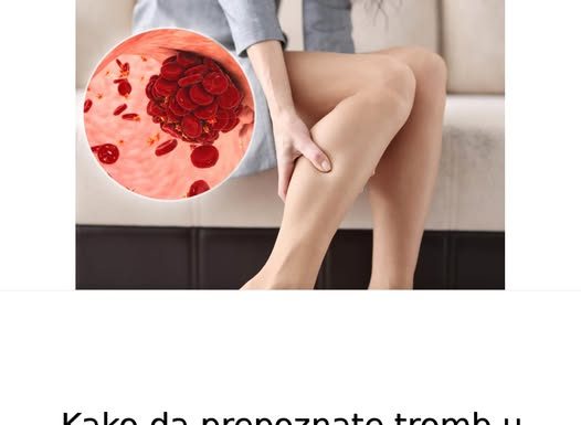 Kako da prepoznate tromb u telu? Ne ignorišite ovih 8 znakova upozorenja