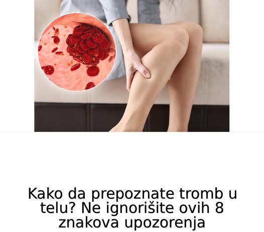 Kako da prepoznate tromb u telu? Ne ignorišite ovih 8 znakova upozorenja
