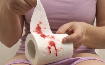 PRIMIJETILI STE KRV NA WC PAPIRU – evo šta vam tijelo pokušava reći: Obratite pažnju, MOŽE BITI OPASNO