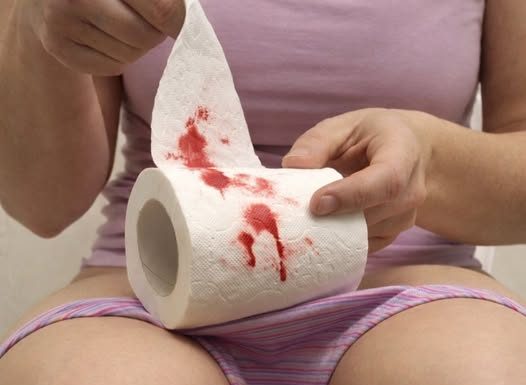 PRIMIJETILI STE KRV NA WC PAPIRU – evo šta vam tijelo pokušava reći: Obratite pažnju, MOŽE BITI OPASNO