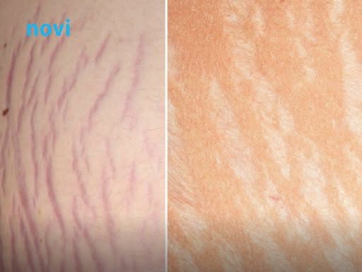 Jedna biljka kao skalpelom briše sve ožiljke, opekotine i strije, a koža se podmlađuje