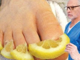 U POTPUNOSTI UNIŠTITE GLJIVICE NA NOKTIMA: 10 najboljih narodnih načina za borbu protiv gljivica