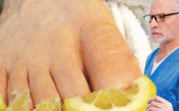 U POTPUNOSTI UNIŠTITE GLJIVICE NA NOKTIMA: 10 najboljih narodnih načina za borbu protiv gljivica