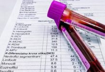 TUMAČENJE KRVNE SLIKE: Šta znače sve one skraćenice i na šta upućuju njihove vrednosti!