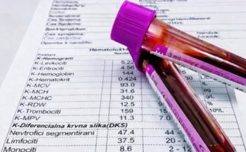 TUMAČENJE KRVNE SLIKE: Šta znače sve one skraćenice i na šta upućuju njihove vrednosti!
