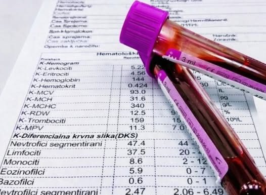 TUMAČENJE KRVNE SLIKE: Šta znače sve one skraćenice i na šta upućuju njihove vrednosti!