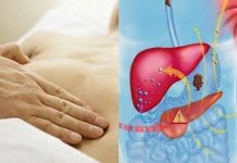 SAČUVAJTE JETRU NA VRIJEME: Evo šta je najviše uništava, a čime je možete obnoviti