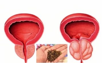 Spas za muškarce: Riješite probleme prostate na prirodan način!