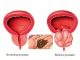 Spas za muškarce: Riješite probleme prostate na prirodan način!