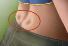 DISKUS HERNIJA: Ovaj DOMAĆI LIJEK potpuno OBNAVLJA KIČMU, JAČA JE I LIJEČI