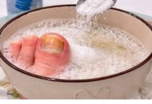 Samo 3 sastojka za žute i zadebljale nokte! GLJIVICE NA NOKTIMA KAO RUKOM ODNESENE…