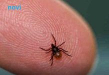 Ova stvar na čarapi najbolje tjera krpelje