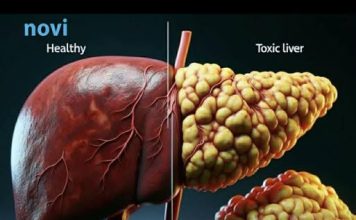 5 skrivenih znakova raka jetre: Često se ignorišu, a ljudi preko 50 godina su u najvećem riziku