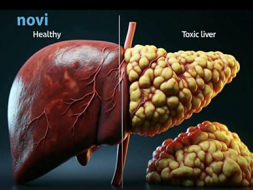 5 skrivenih znakova raka jetre: Često se ignorišu, a ljudi preko 50 godina su u najvećem riziku