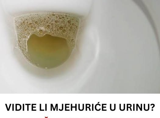 Vidite li mjehuriće u urinu? To može ukazivati na ozbiljnije zdravstveno stanje!