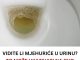 Vidite li mjehuriće u urinu? To može ukazivati na ozbiljnije zdravstveno stanje!