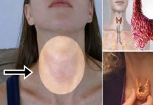 2 OPAKA SIMPTOMA ŠTITNE ŽLIJEZDE NIKAKO NE SMIJETE IGNORISATI! Lako se primjete i ODMAH VAM JE LOŠE, a donose NEVOLJU