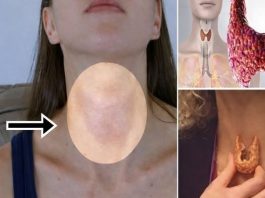 2 OPAKA SIMPTOMA ŠTITNE ŽLIJEZDE NIKAKO NE SMIJETE IGNORISATI! Lako se primjete i ODMAH VAM JE LOŠE, a donose NEVOLJU