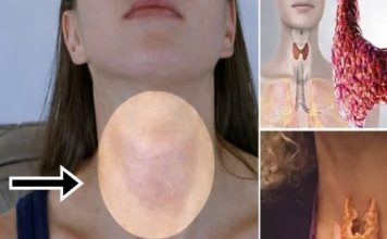 2 OPAKA SIMPTOMA ŠTITNE ŽLIJEZDE NIKAKO NE SMIJETE IGNORISATI! Lako se primjete i ODMAH VAM JE LOŠE, a donose NEVOLJU