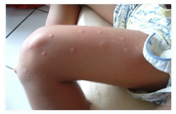 KOMARCI!? Nakon ovoga više nikada ih nećete ni vidjeti… DOVOLJNO JE SAMO PREPOLOVITI OVO VOĆE i…