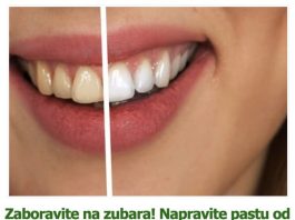 Zaboravite na zubara! Napravite pastu od tri sastojka koja uklanja kamenac i izbjeljuje zube