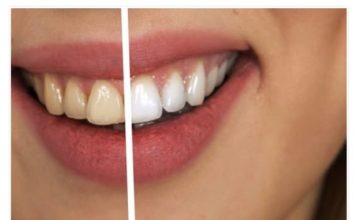 Zaboravite na zubara! Napravite pastu od tri sastojka koja uklanja kamenac i izbjeljuje zube