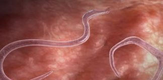 OVI ZNAKOVI UKAZUJU NA PARAZITE U STOLICI: Kako da prepoznate jesu li vam napali crijeva