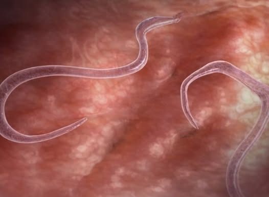 OVI ZNAKOVI UKAZUJU NA PARAZITE U STOLICI: Kako da prepoznate jesu li vam napali crijeva