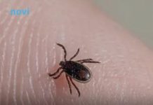 Šta da radite kada se na vas zakači krpelj: Ovo je jedino ispravno rješenje