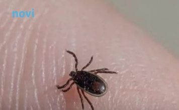 Šta da radite kada se na vas zakači krpelj: Ovo je jedino ispravno rješenje