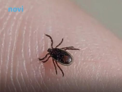Šta da radite kada se na vas zakači krpelj: Ovo je jedino ispravno rješenje