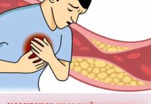 NAMIRNICA KOJA RUŠI HOLESTEROL: Kardiolozi je nazvali savršenom za zdravo srce – odličan je izvor proteina i vitamina