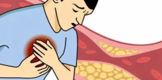 NAMIRNICA KOJA RUŠI HOLESTEROL: Kardiolozi je nazvali savršenom za zdravo srce – odličan je izvor proteina i vitamina