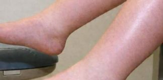 DA IZBACITE VIŠAK VODE POTREBAN VAM JE JEDAN VITAMIN: Ni noge vam više neće oticati, samo ga ubacite u ishranu