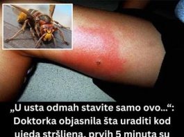 „U usta odmah stavite samo ovo…“: Doktorka objasnila šta uraditi kod ujeda stršljena, prvih 5 minuta su ključni