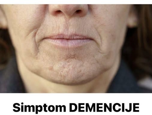 Simptom DEMENCIJE koji se javlja u ustima: Ako ga osjetite, obratite se ljekaru