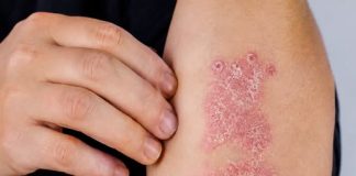 NIKAD VIŠE NEĆETE BACITI KORU OD OVE VOĆKE: Liječi psorijazu, skida bradavice i izbjeljuje zube
