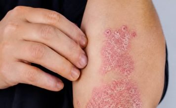 NIKAD VIŠE NEĆETE BACITI KORU OD OVE VOĆKE: Liječi psorijazu, skida bradavice i izbjeljuje zube
